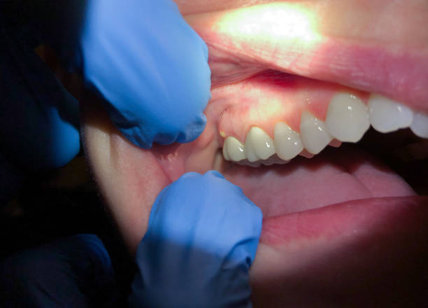 Best Urgent Care for Lost Fillings or Crowns in Aransas Pass, TX